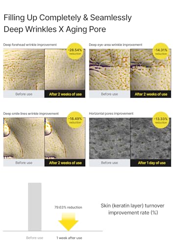 celimax The Vita A Retinal Shot Tightening Booster | with Retinal 0.1%, Matryxyl 3%, Pore Minimiser, Wrinkles & Fine Lines, Firmer Skin, 15 ml